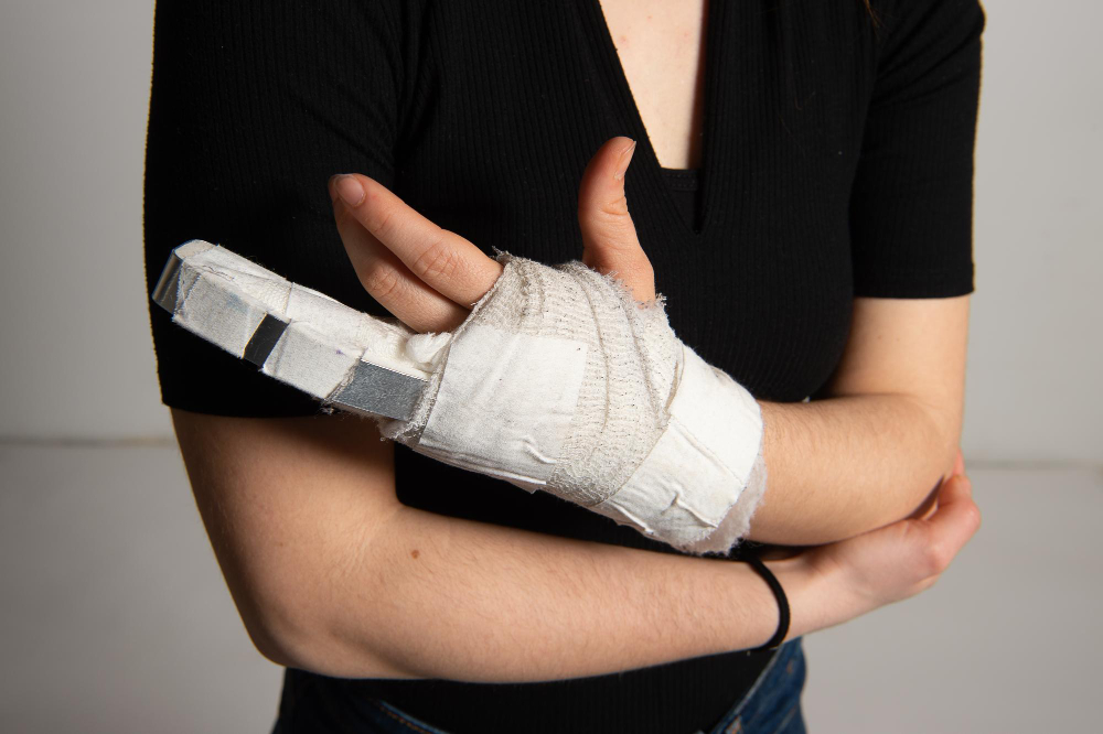 Auxílio-Acidente - mulher com dedo quebrado